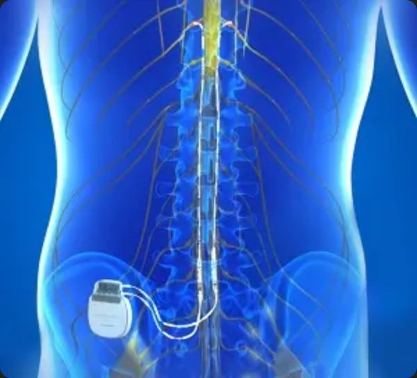 Florida Spine & Pain Center – Spine Pain Management in Broward County 23 Spine pain management in Broward County