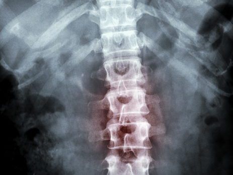 Pain management specialists in South Florida