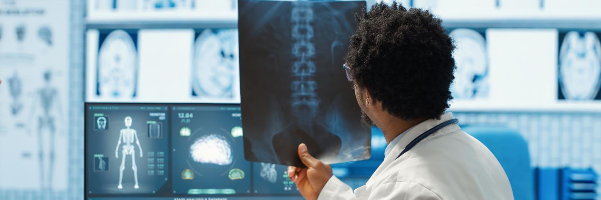 Doctor reviewing spinal X-ray while discussing BlueCross BlueShield coverage for pain management treatments