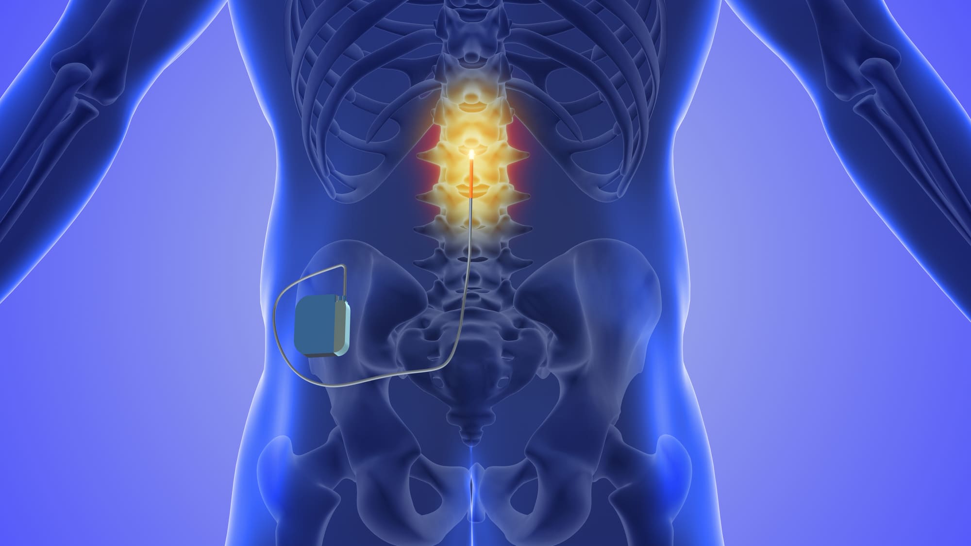 Florida Spine & Pain Center – Comprehensive Pain Management 11 Trusted pain care and rehabilitation