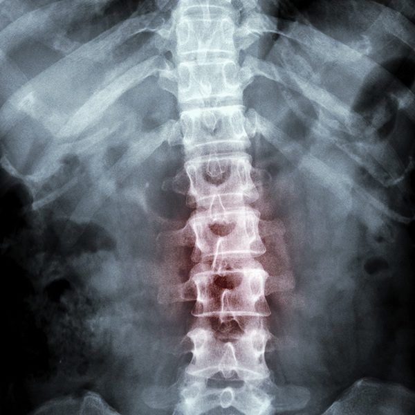 Pain management specialists in South Florida